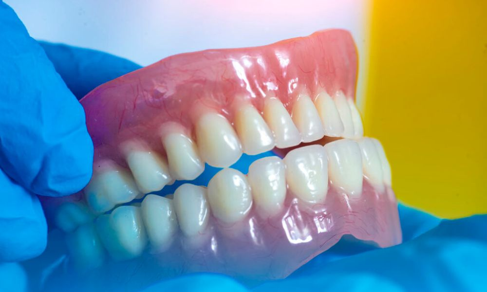 Complete dentures for full arch replacement