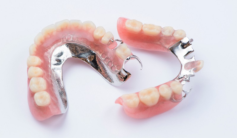 Removable dentures service